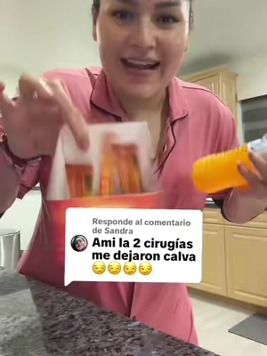 Respuesta a @Sandra 