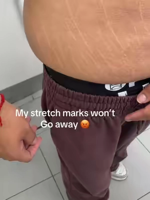 7687801741781355790