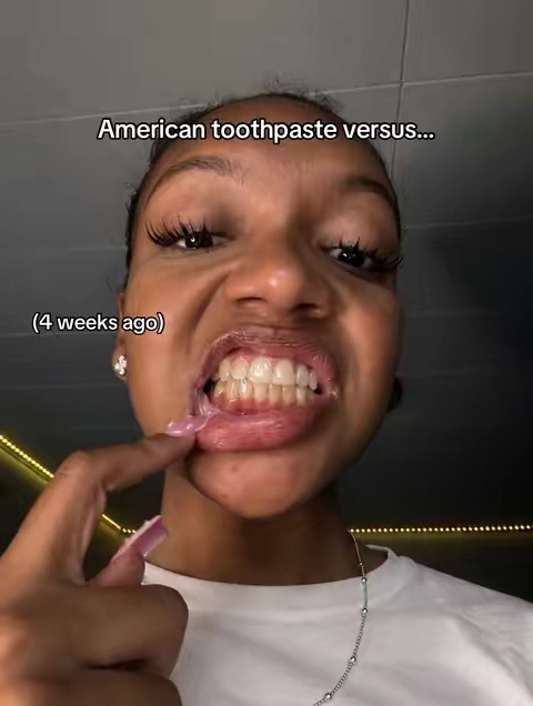 #teethwhitening #mouthology 