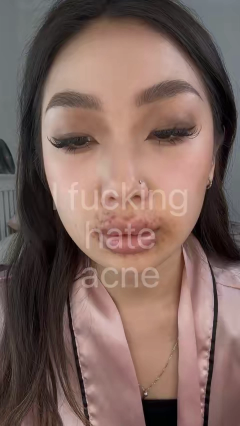 #acne #acnetreatment #drleodryinglotion #CityTasteTest #skincaretips 