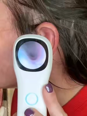 This is a must have, doesn’t matter if you have 2 or 4 legged kids. It works on both #endoscope #earaxremoval #earcamera #medicaldevice #momlife 