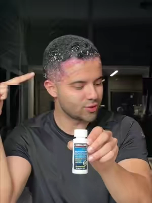 Yo estaba resignado con la genética, pero encontré algo que cambió el juego — ahora mis colegas me preguntan qué hago diferente. 💯🔥 #hairgrowth #hairloss #mengrooming #haircare #hairtransformation Disclaimer: results may vary 