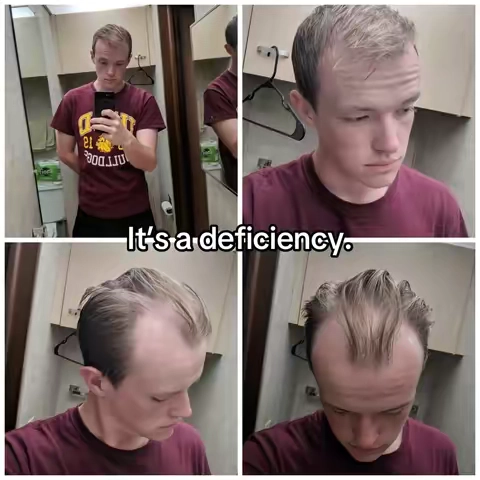 #dht #dhtblocker #hairloss 