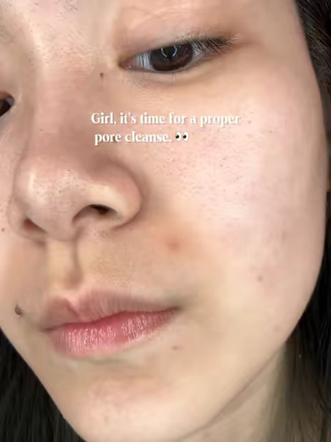 POV: you finally found a clay mask you actually keep coming back to 👀 Been using this 2–3x a week and honestly… consistency is key. Not a 10-step routine. Just me actually sticking with my skincare. 😭#skincare #skincareroutine #sensitiveskin #clearskin #drleohonestreview 