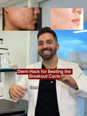 Azelaic acid is one of the best Derm hacks for beating the breakout cycle‼️