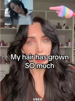 @Dr. Groot Hair has been one of the main things that has helped get my hair as healthy as it currently is. You can see my hair transformation in the playlist below so you can see I’ve been using this for several years. If you are looking for longer healthier stringer hair this k beauty brand is the way to go!! #drgroot #drgrootbeforeandafter #drgrootscalprevitalizingsolution #healthyhairjourney #healthyhaircare 