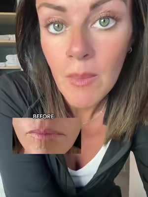 Plump your lips without the sting. Hydrate, smooth and plump with the new DRMTLGY 4D lip volumizer. Has a gloss color on it that's perfect! #drmtlgyskincare #drmtlgy #lipfiller #lipplumper #lipplumpergloss 