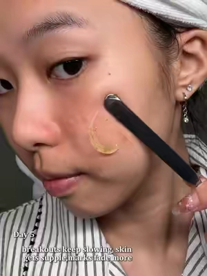 If your barrier is damaged, this is for you.🧖🏻‍♀️💚#skincare #skincareroutine #skinbarrierrepair #acnetreatment #drleohonestreview 