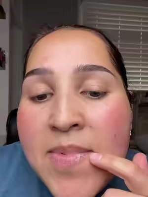#fyp#viral#labios 