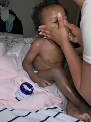 trigger warning this may be hard to watch. #prayer #eczemahealing #HealingJourney #theoceanhealedmyeczema #dealsforyoudays  @Healed By The Ocean 