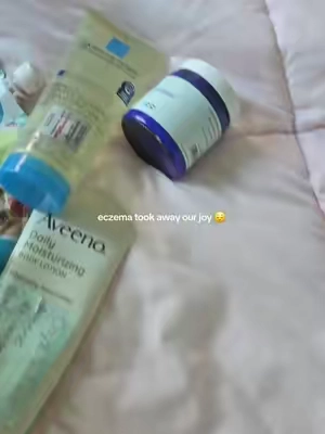 #triggerwarning #HealingJourney #theoceanhealedmyeczema  #eczemaawareness #eczemaflareup   