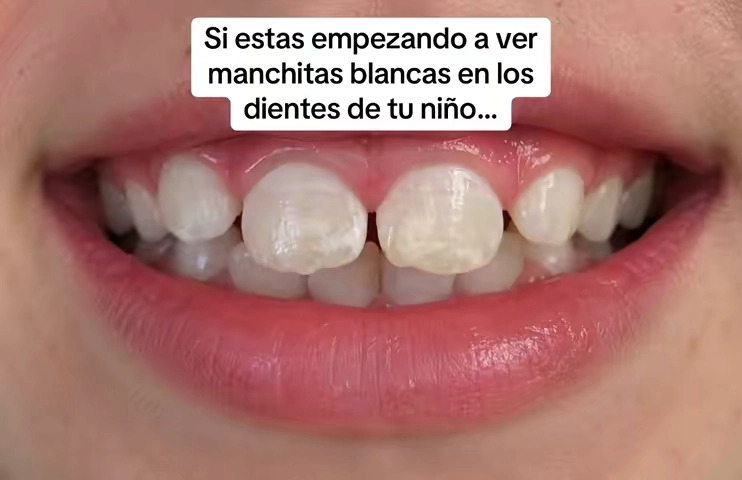 Consulta con tu dentista y veras!!! Tambien lee las reseñas!!! 