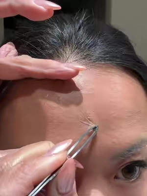 Dr. Melaxin’s pimple patches are practically Invisable! #drmelaxin #pimplepatches #koreanskincare #drmelaxinpimplepatches #acne 