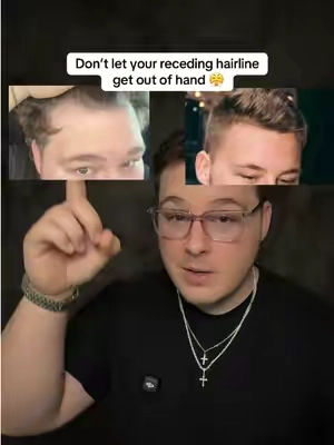 Hims is legit and they have a great deal right now! #menshaircare #menhaircare #recedinghairline #tiktokshopstockup #tiktokshopfalldealsforyou 