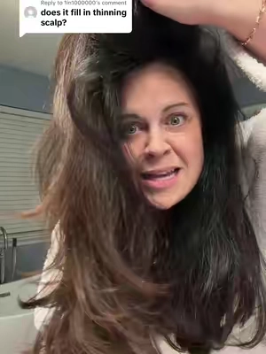 Replying to @1in1000000 I am thankful every day for the positive changes in my hair! My hair grows extremely fast, is thicker than it has ever been, and I have new growth all over the place! Results will vary. I am not a doctor and this is not medical advice. #Hair #HairGrowth #HairSupport #ThickerHair #ThinningHair 