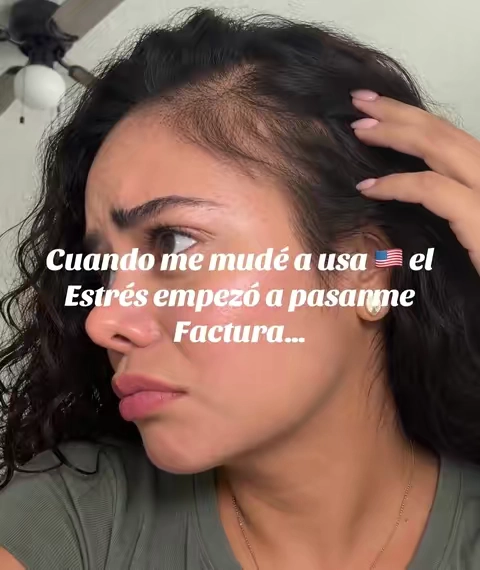 #hairgrowth #caidadecabello #crecimientodelcabello #cabellolargo #hairvitamins 