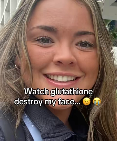 Adding glutathione to my supplestack has supported my glowup journey SOOO much.  Glutathione benefits. Glutathione results.  Results may vary & this is my own personal experience  #glutathione #liposomalglutathione #glutathioneglow #glutathionecapsules 