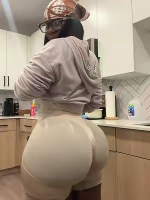 Snatched body >>> #postop #surgerytok #viral 