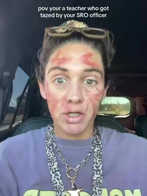If your ever in this situation, you know you can use the Tarte color correcting tinted serum  @tarte cosmetics #tartecctintedserum #colorcorrection #tarte #tintedserum 