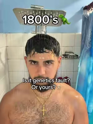 What kind of shampoo are you using?😳👨🏼‍🦲